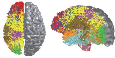 ibm-brain-2 