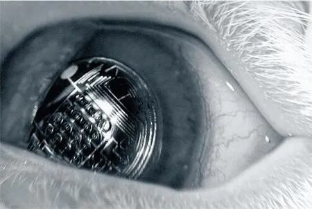 lens1 