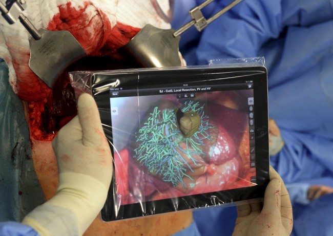 ipad-operacja