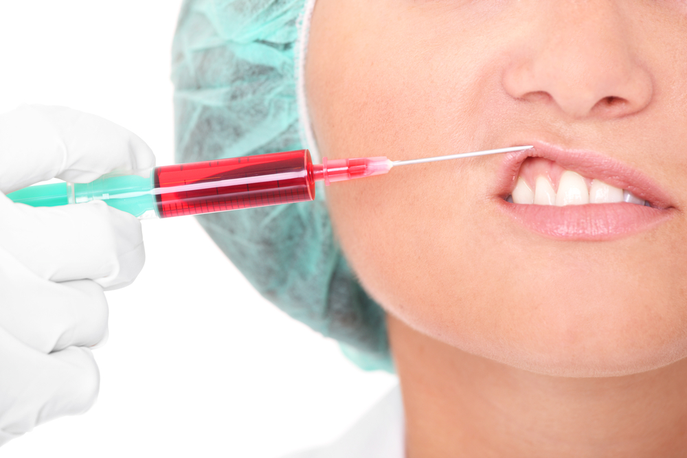 A picture of a young woman having a plastic surgery class="wp-image-167805" 
