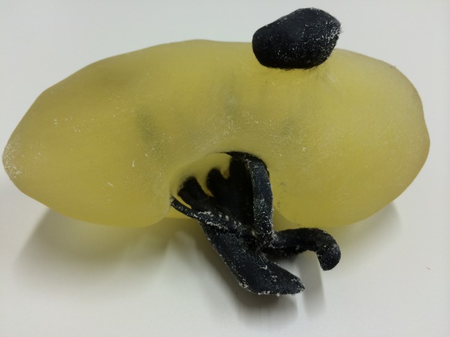 Printed kidney with tumour 2