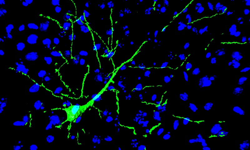 ImageJ=1.48e class="wp-image-226372" 