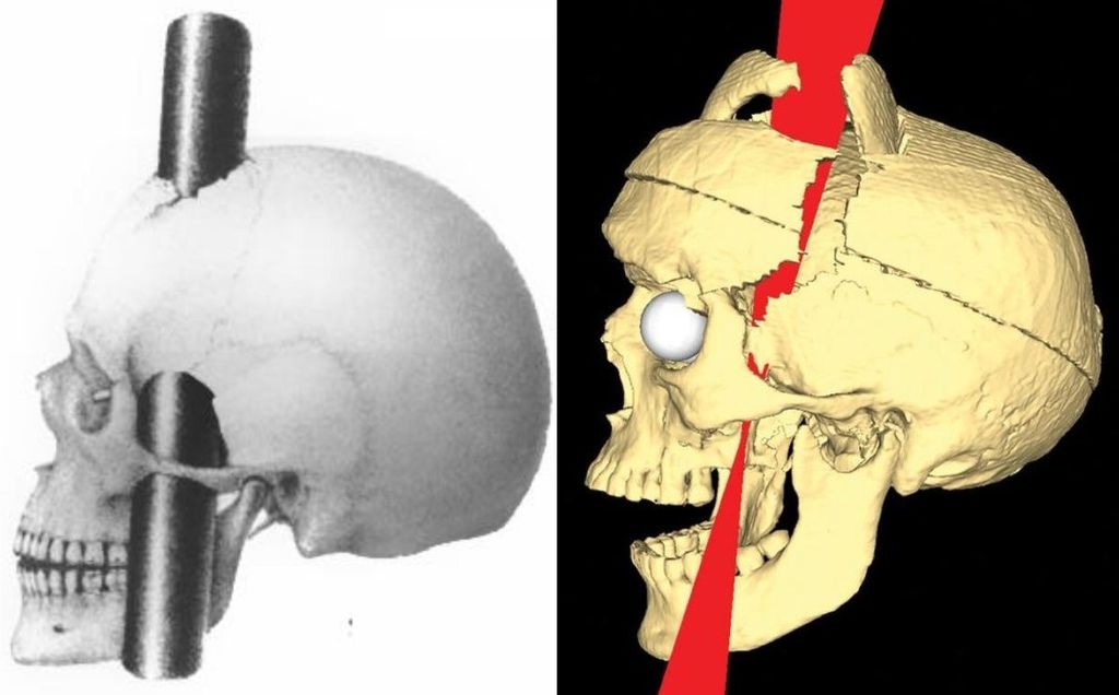 PhineasGage_IronPaths_BigelowRatiuCombined class="wp-image-250449" 