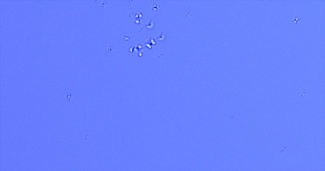 Leica-M9-sensor-white-spots-corrosion-issues-reported