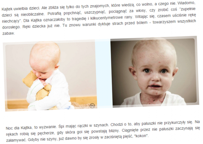 Fragment strony SiePomaga, na której zbierane są pieniądze dla Kajtka. class="wp-image-398112" 