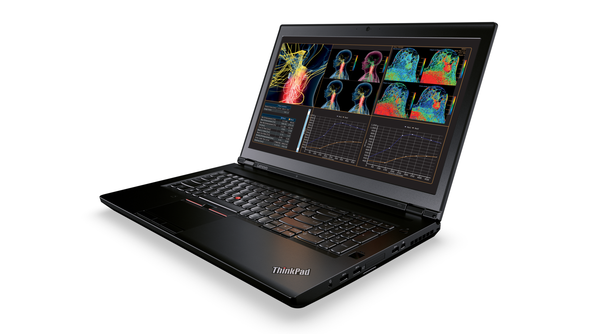 Thinkpad_P71 class="wp-image-543251" 