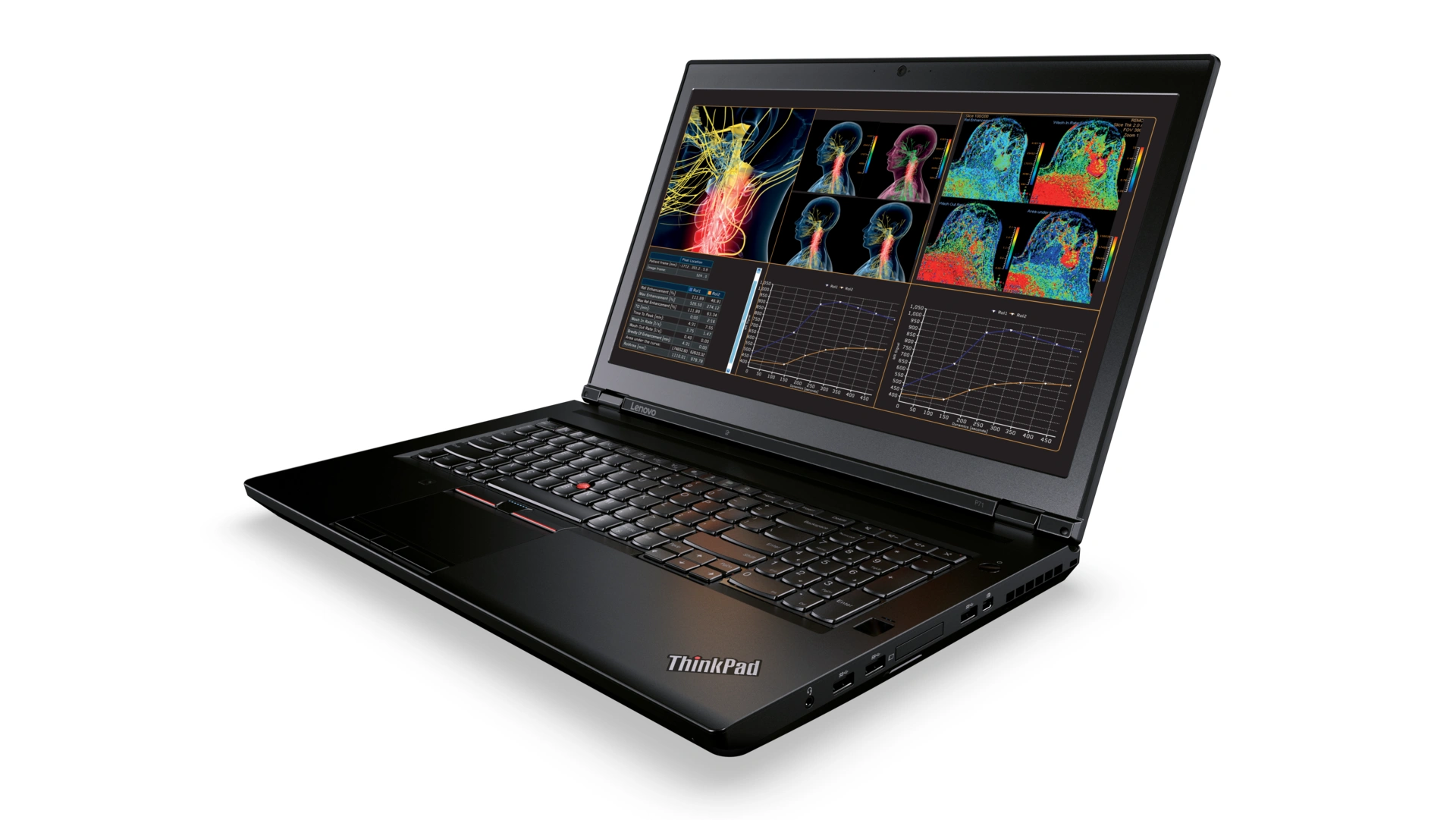 Thinkpad_P71 class="wp-image-543251"