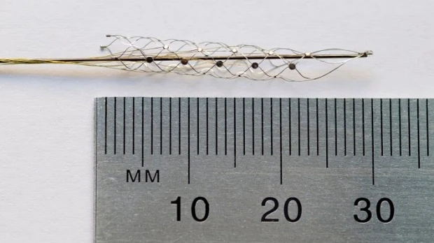 Bioniczny kręgosłup class="wp-image-543634" 