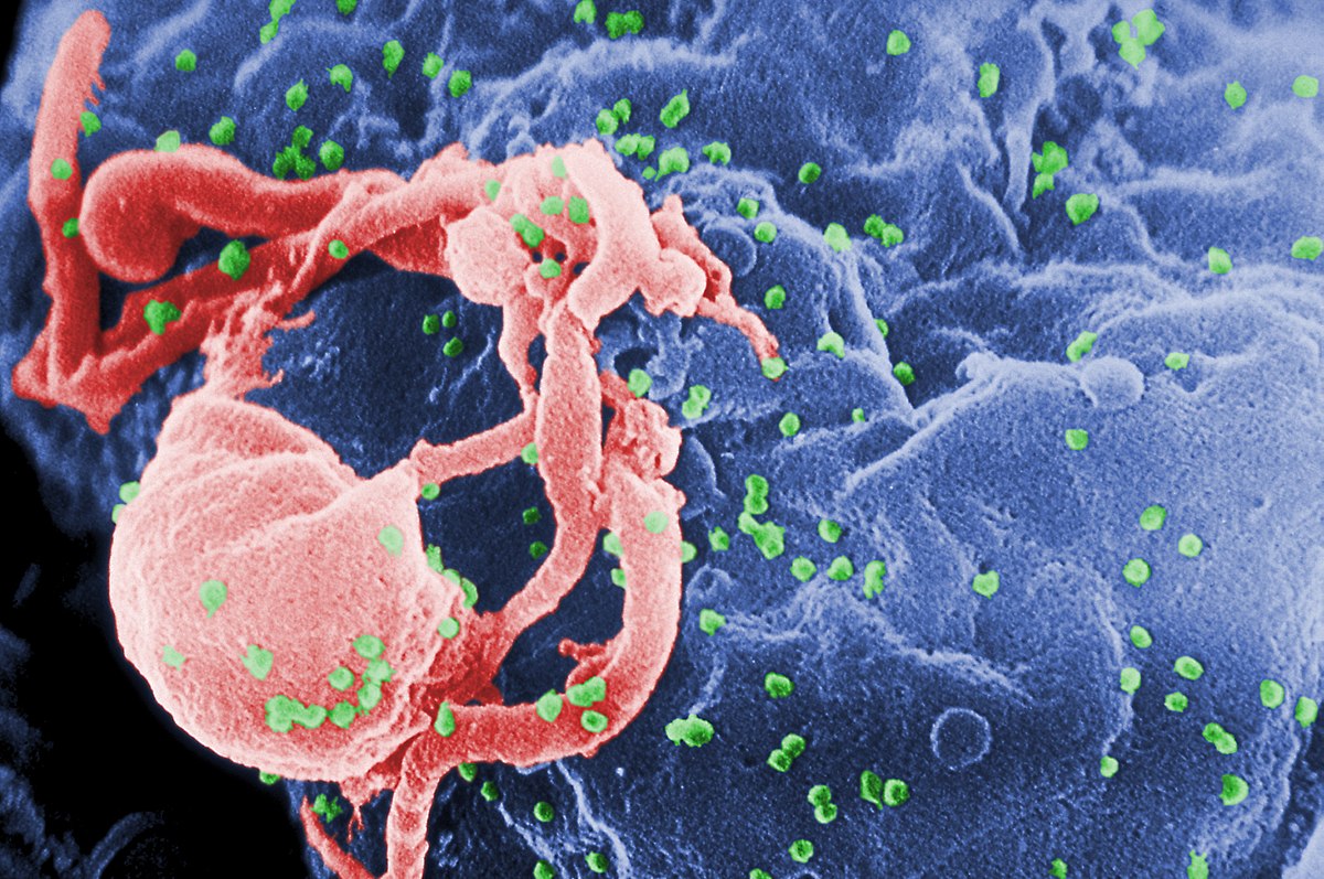 Nadal są ludzie, którzy nie wierzą w istnienie HIV. Serio
