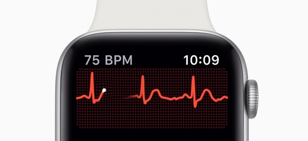 apple watch series 4 ekg elektrokardiogram 7 class="wp-image-915084" 
