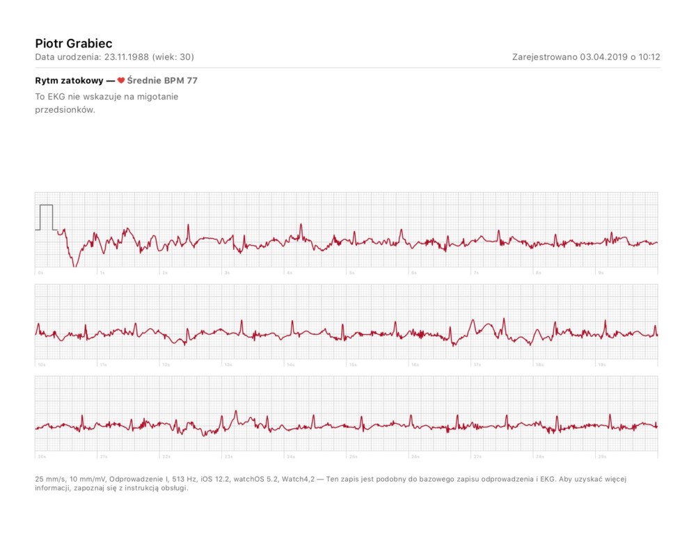 apple watch ekg badanie wyniki porównanie 2 class="wp-image-945035" 