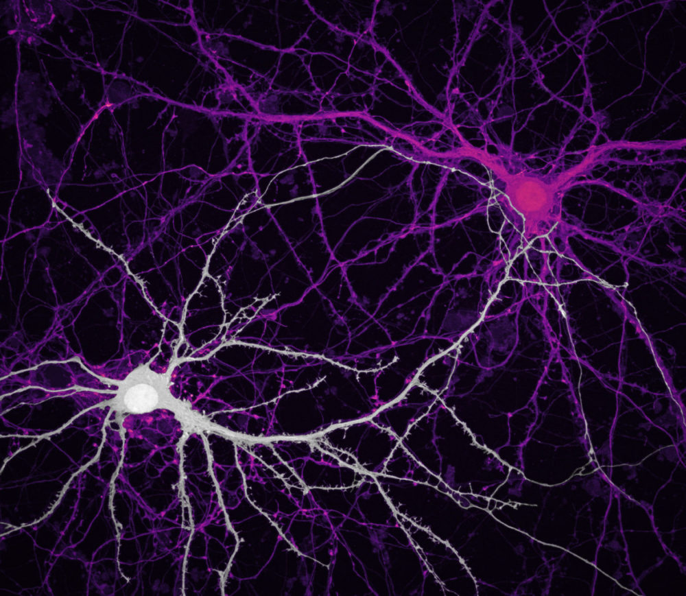 Fot. Jason Kirk, Quynh Nguyen, komórki nerwowe (neurony), 9. miejsce class="wp-image-1466324"