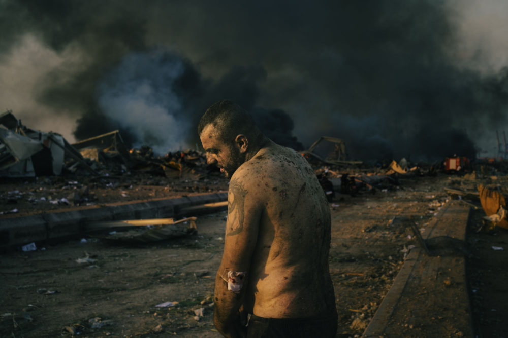 Fot. Valery Melnikov, Rosja, "Leaving Home in Nagorno-Karabakh" / World Press Photo 2021 class="wp-image-1625519"
