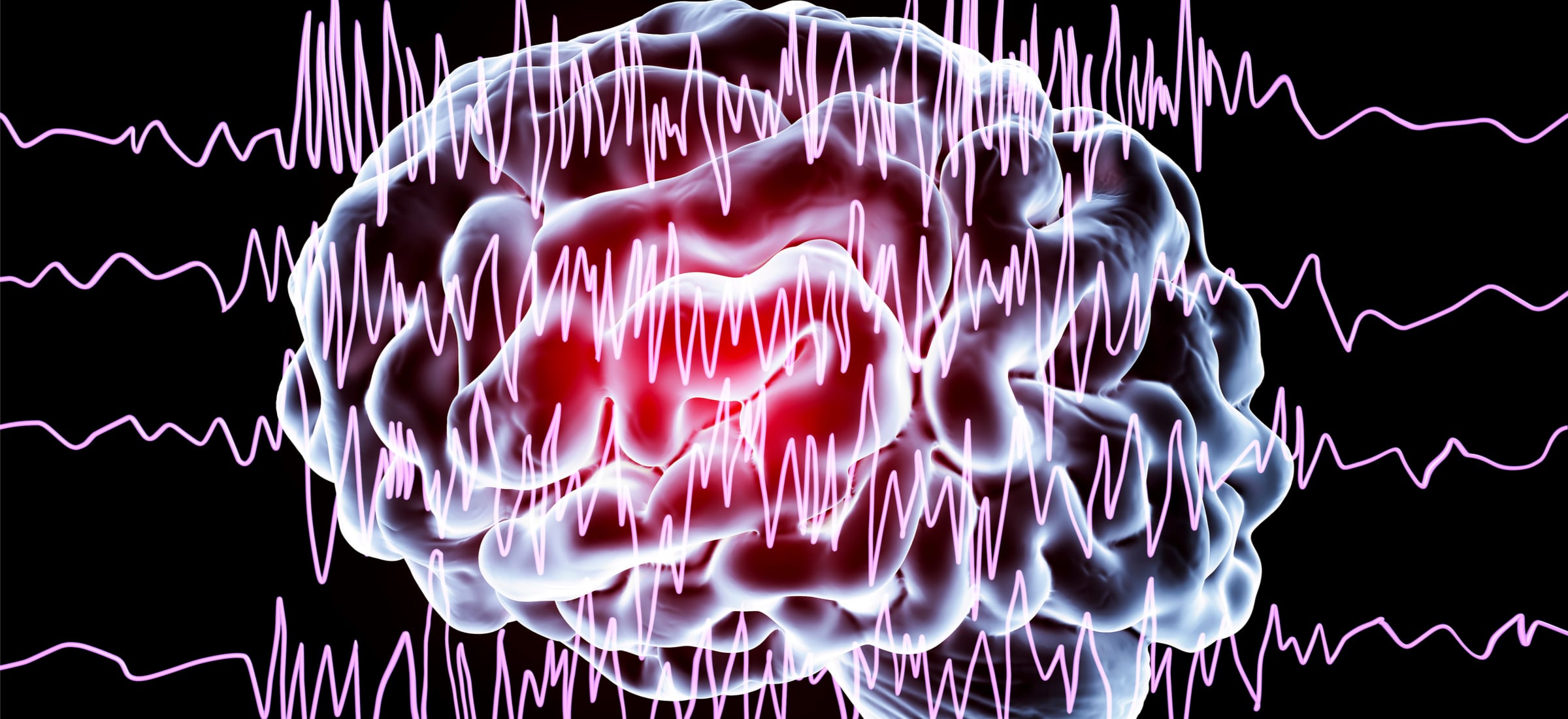 eeg