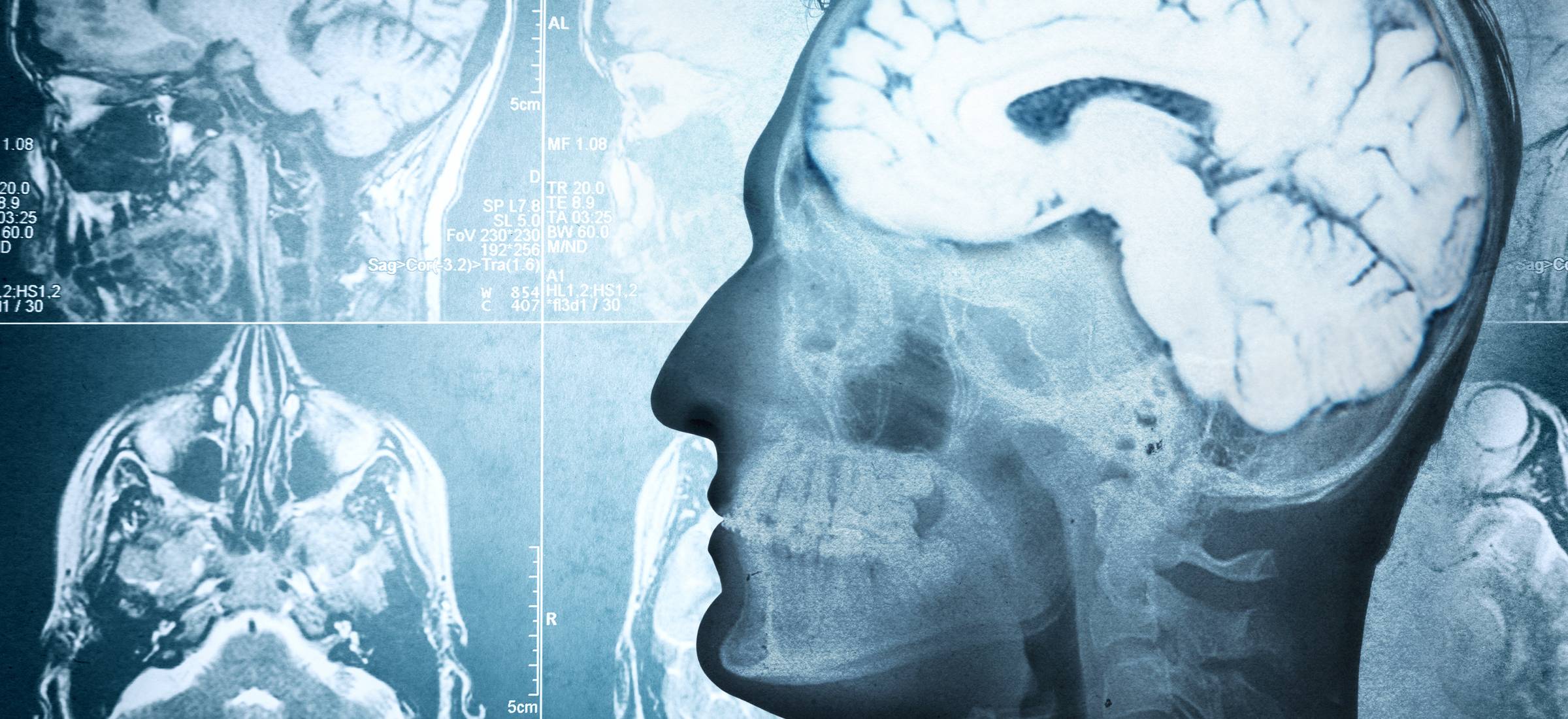 Neuroplastyczność mózgu to fakt. Tkanki uczą się nowych funkcji
