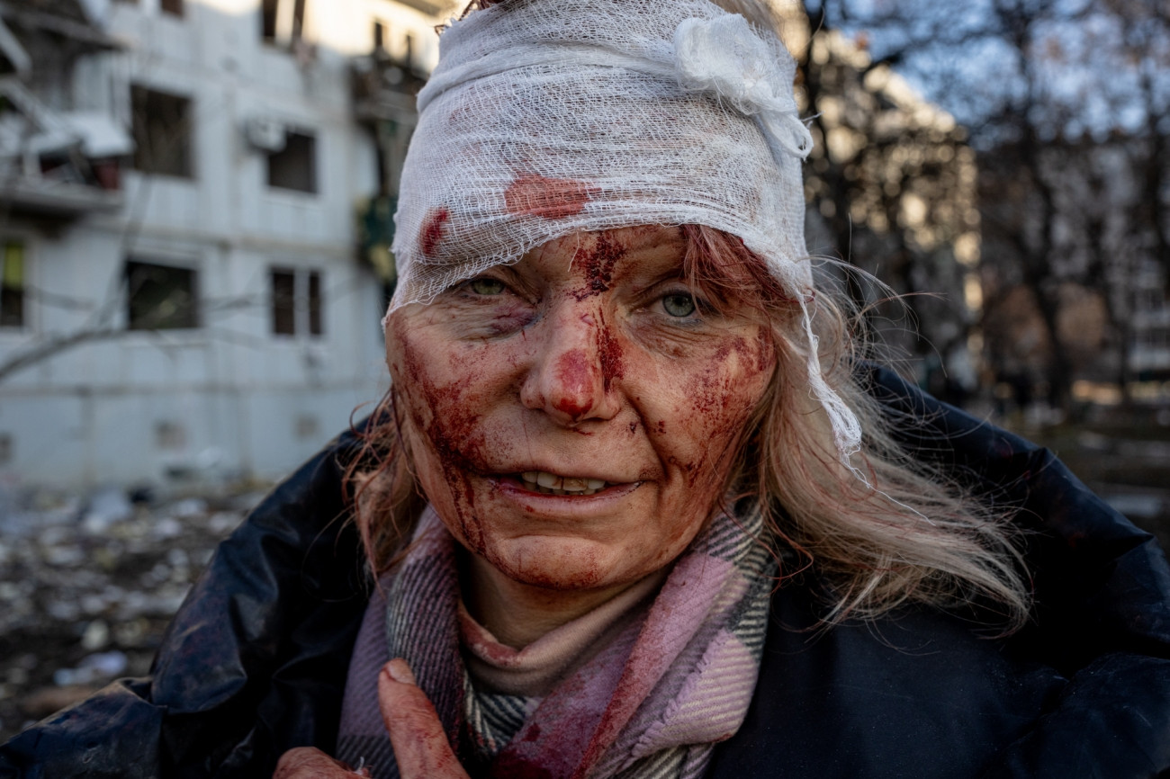 Fot. Wolfgang Schwan, z cyklu &quot;Ukraine's War&quot;, nagroda Best Author / Siena International Photo Awards 2023. 