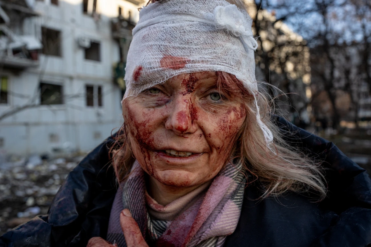 Fot. Wolfgang Schwan, z cyklu &quot;Ukraine's War&quot;, nagroda Best Author / Siena International Photo Awards 2023. 