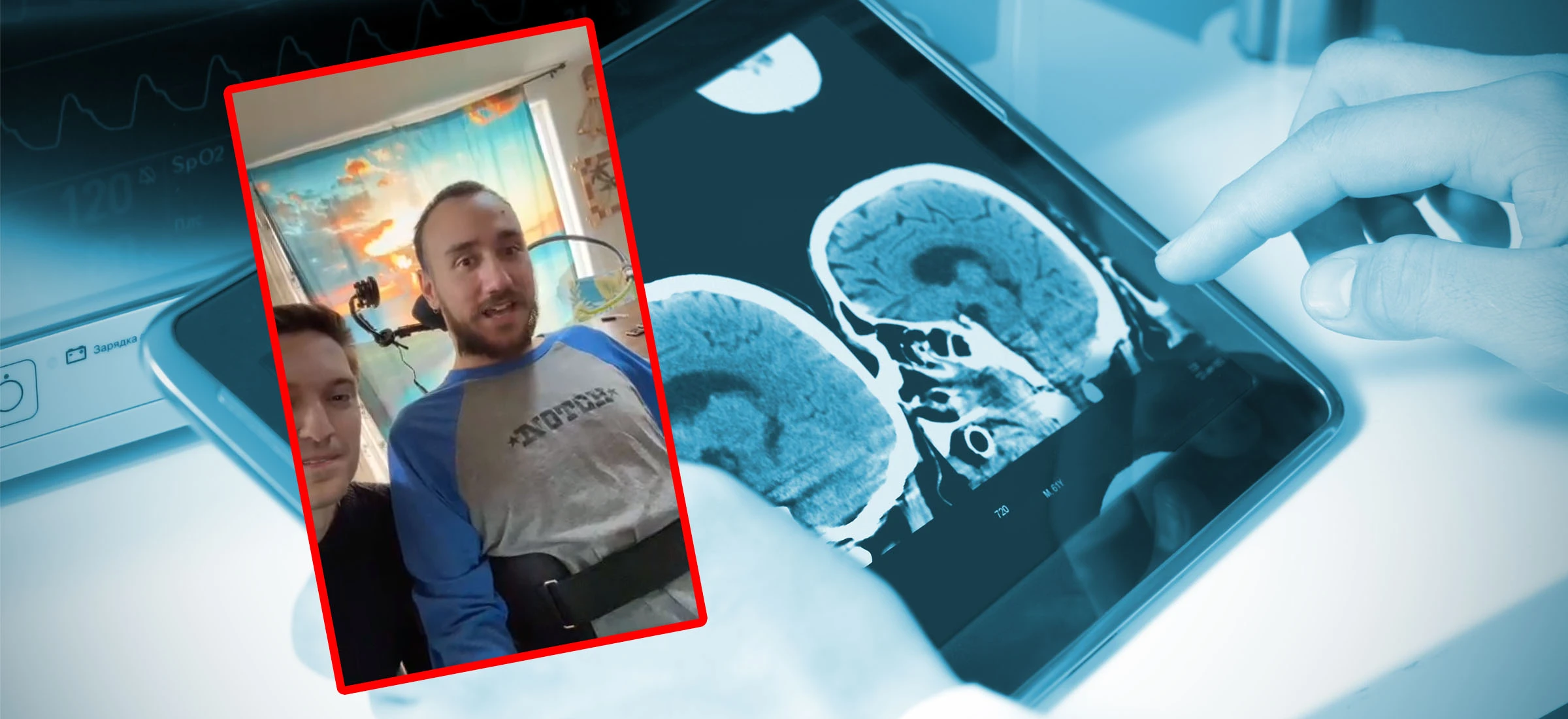 Ten człowiek steruje komputerem za pomocą myśli. Neuralink pokazał nagranie