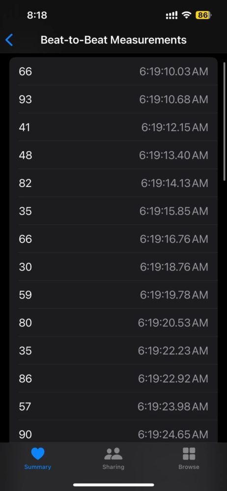 https://ocs-pl.oktawave.com/v1/AUTH_2887234e-384a-4873-8bc5-405211db13a2/spidersweb/2024/10/apple-watch-ratowanie-zycie-2024-1-462x1000.jpeg