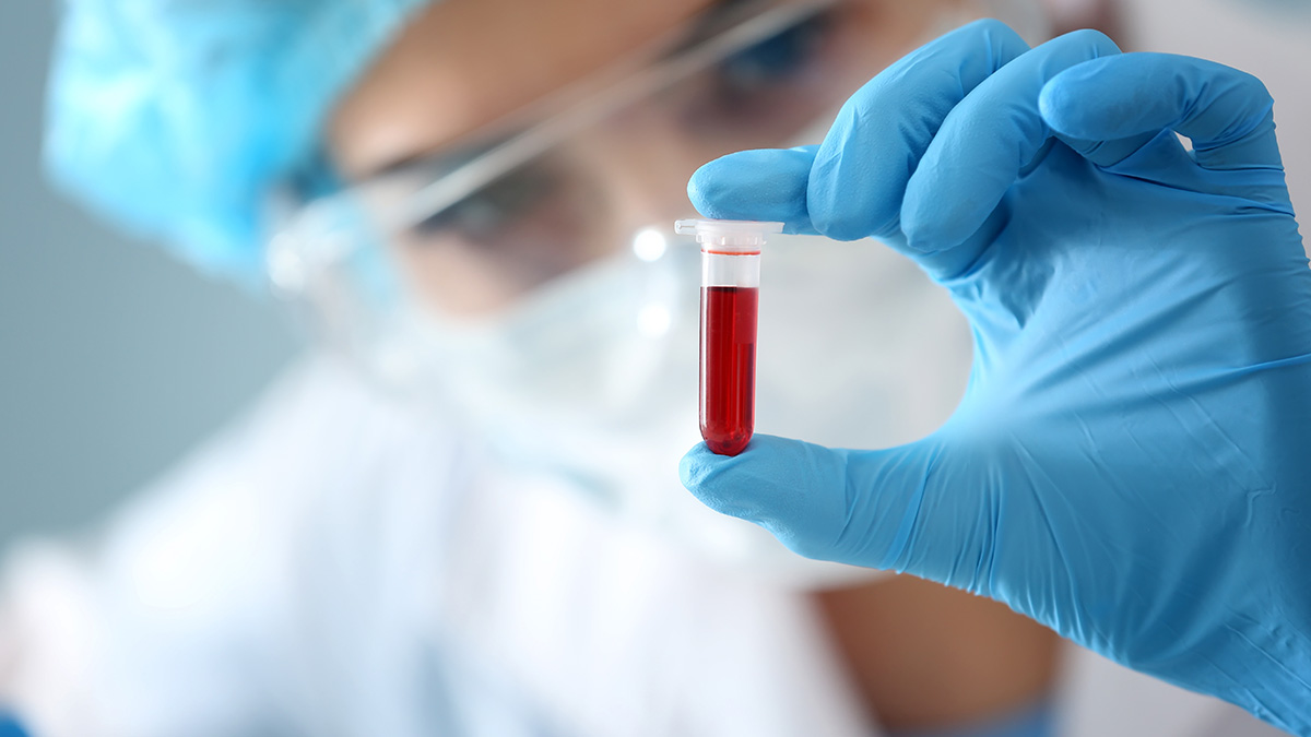 Francuscy naukowcy ogłosili odkrycie "ultra rzadkiej" grupy krwi. Gwada ujemna, oficjalnie uznana przez ISBT, otwiera nowy rozdział w historii hematologii.