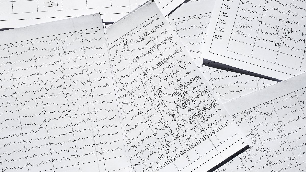 Rewolucja w badaniu EEG. „Tanie i niezwykle skuteczne”