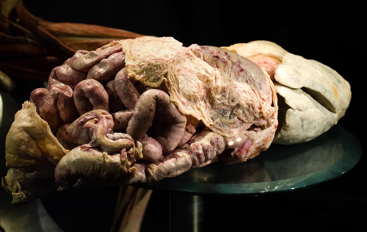 Polska tworzy sztuczne jelita. Chcemy odwzorować biologię 1 do 1