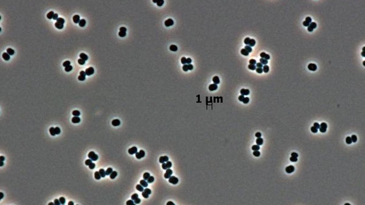 Zombie w laboratorium NASA. Bakterie, które przeraziły badaczy