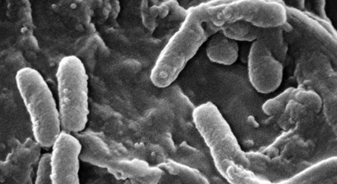 Image for Jest polski patent na groźną superbakterię. Szpitale odetchną