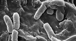 Jest polski patent na groźną superbakterię. Szpitale odetchną