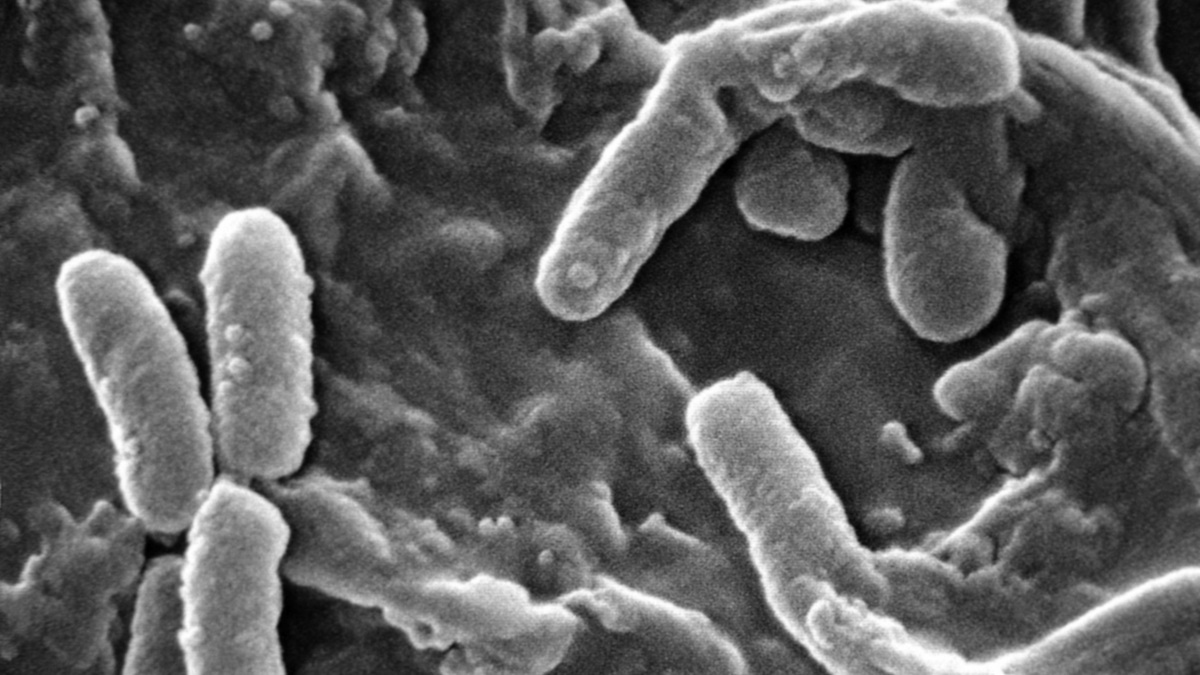 Jest polski patent na groźną superbakterię. Szpitale odetchną