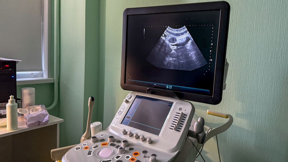 Nowe ultrasonografy trafiają na rynek. Stawka jest wysoka