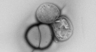 Ta bakteria jest nie do zdarcia. "Próbowaliśmy ją zabić, ale to niemożliwe"