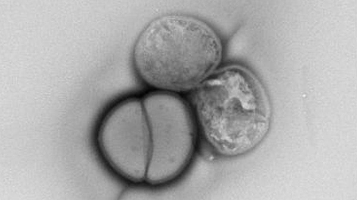 Ta bakteria jest nie do zdarcia. „Próbowaliśmy ją zabić, ale to niemożliwe”